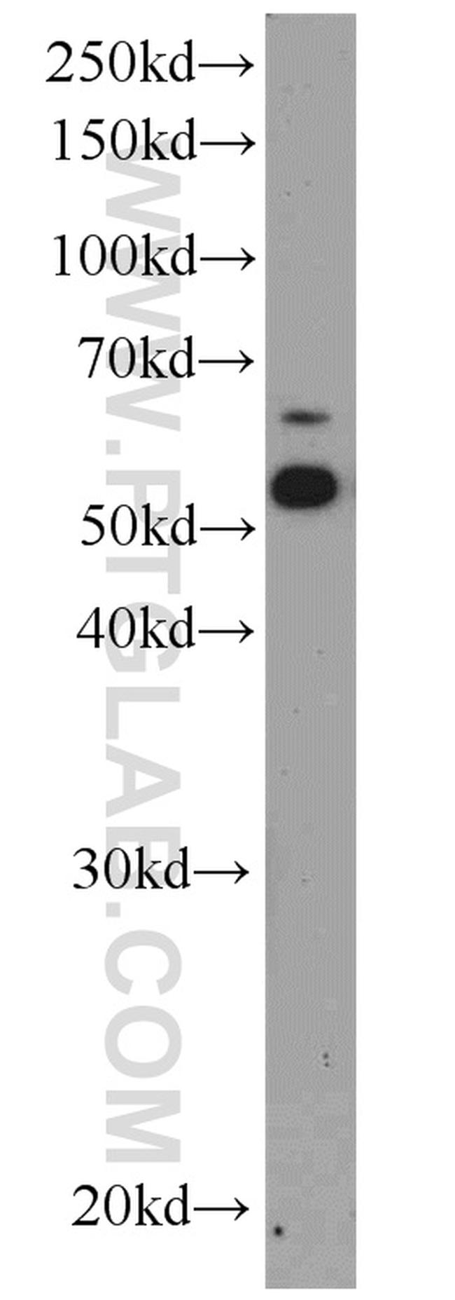 ATP6V1B2 Antibody in Western Blot (WB)