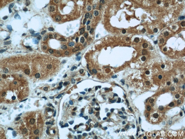 INPP5K Antibody in Immunohistochemistry (Paraffin) (IHC (P))