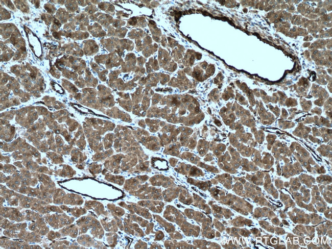 TGM2 Antibody in Immunohistochemistry (Paraffin) (IHC (P))