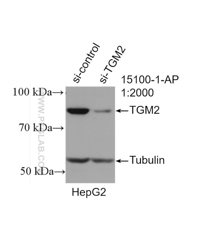 TGM2 Antibody in Western Blot (WB)