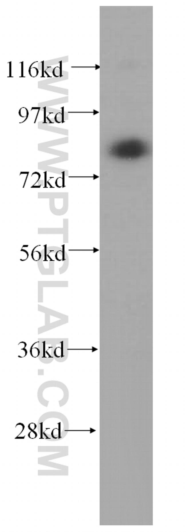 TGM2 Antibody in Western Blot (WB)