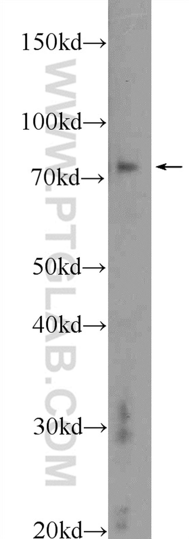 TGM2 Antibody in Western Blot (WB)