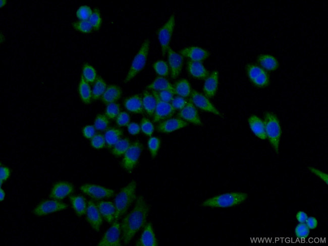 TNIP1 Antibody in Immunocytochemistry (ICC/IF)