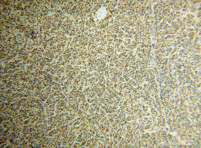 TNIP1 Antibody in Immunohistochemistry (Paraffin) (IHC (P))