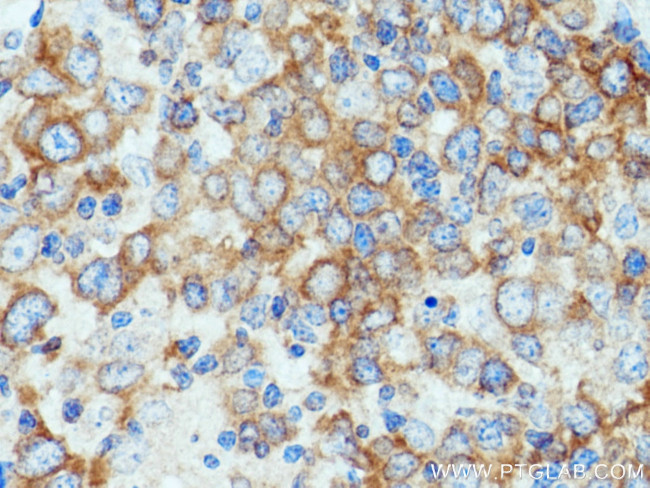 TNIP1 Antibody in Immunohistochemistry (Paraffin) (IHC (P))