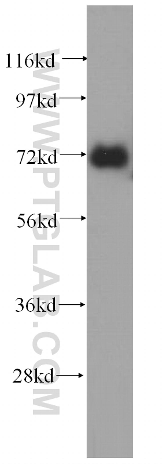 TNIP1 Antibody in Western Blot (WB)