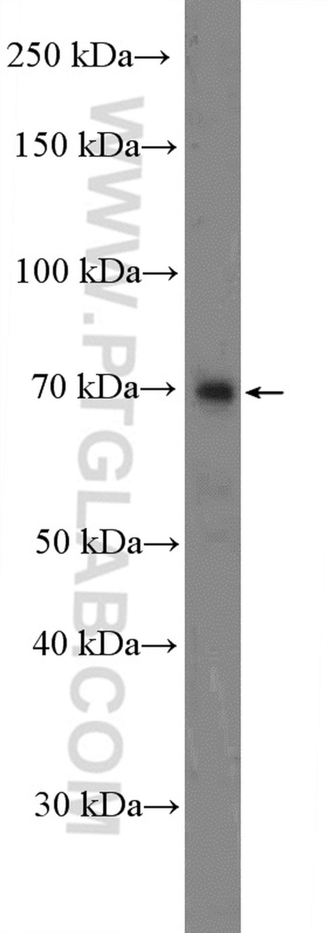 TNIP1 Antibody in Western Blot (WB)