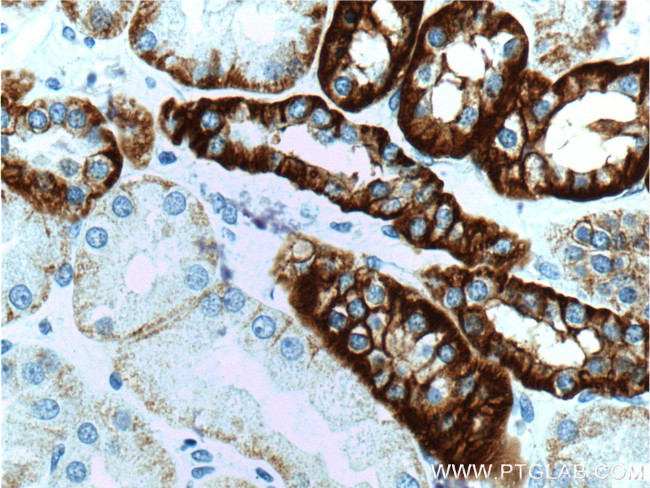 Cadherin-16 Antibody in Immunohistochemistry (Paraffin) (IHC (P))