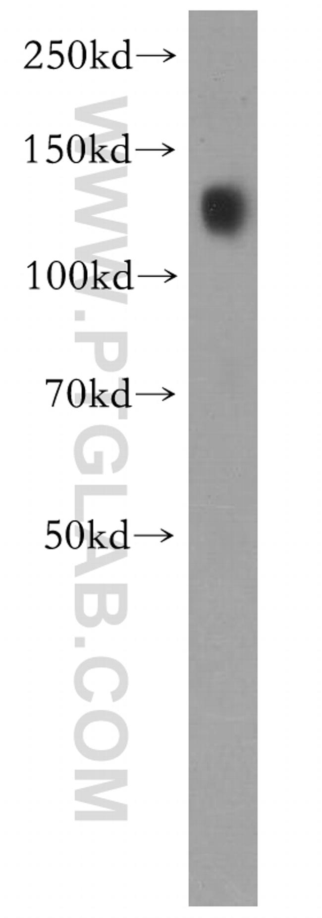 Cadherin-16 Antibody in Western Blot (WB)