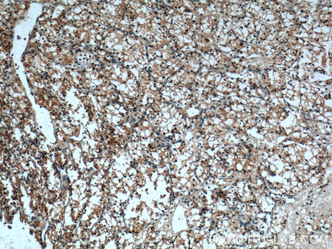 Cadherin-16 Antibody in Immunohistochemistry (Paraffin) (IHC (P))