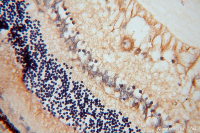 AIPL1 Antibody in Immunohistochemistry (Paraffin) (IHC (P))