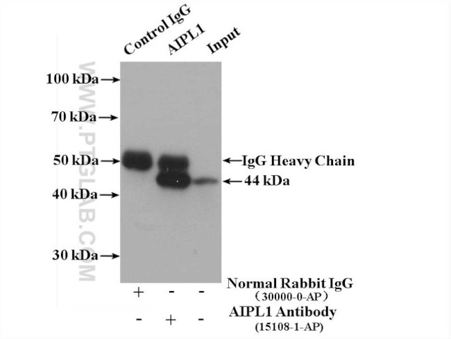AIPL1 Antibody in Immunoprecipitation (IP)