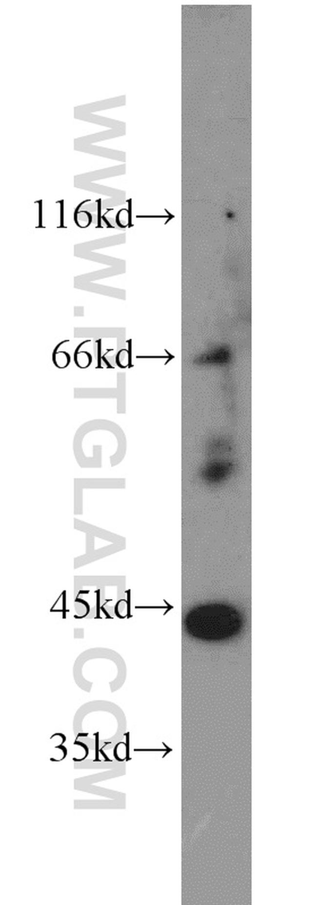 AIPL1 Antibody in Western Blot (WB)