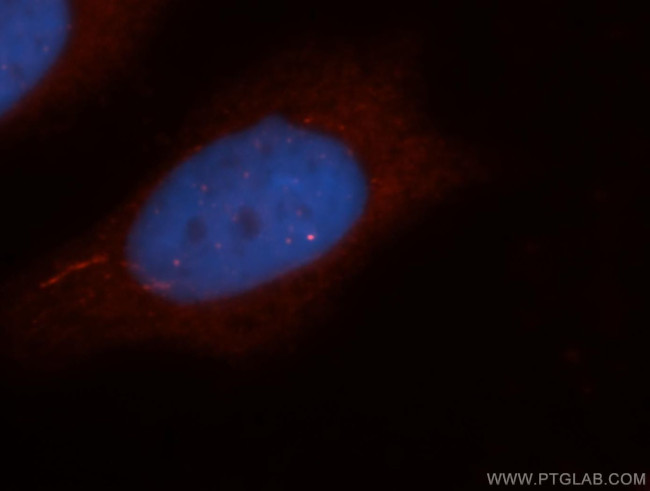 PHKG2 Antibody in Immunocytochemistry (ICC/IF)