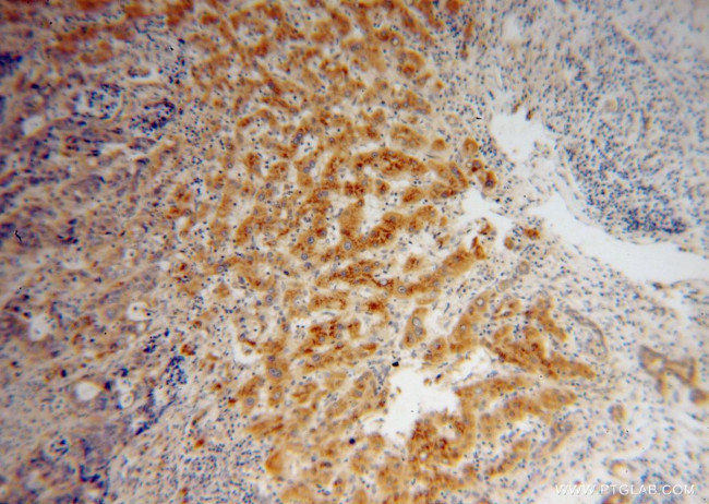 PHKG2 Antibody in Immunohistochemistry (Paraffin) (IHC (P))