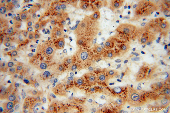 PHKG2 Antibody in Immunohistochemistry (Paraffin) (IHC (P))