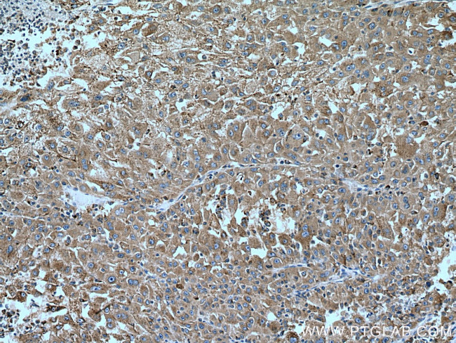 PHKG2 Antibody in Immunohistochemistry (Paraffin) (IHC (P))