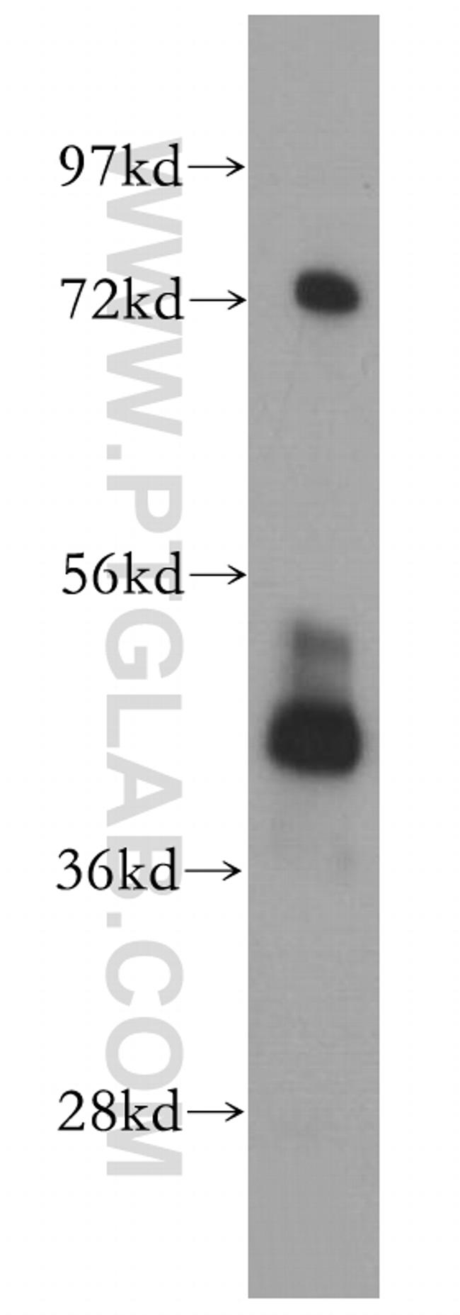 PHKG2 Antibody in Western Blot (WB)