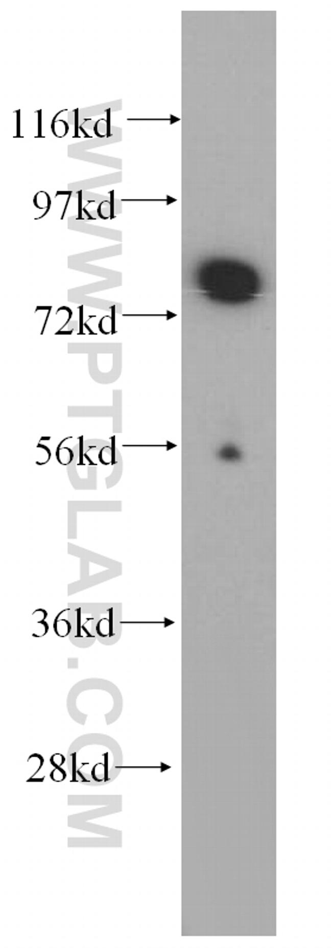 WDR46 Antibody in Western Blot (WB)