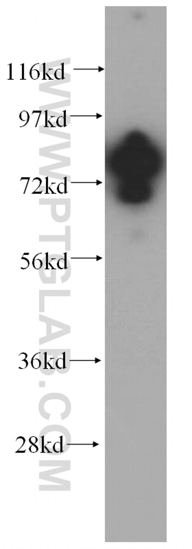 WDR46 Antibody in Western Blot (WB)