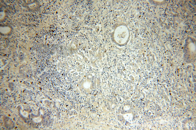 NSDHL Antibody in Immunohistochemistry (Paraffin) (IHC (P))