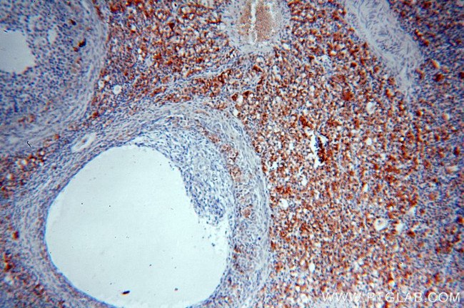 NSDHL Antibody in Immunohistochemistry (Paraffin) (IHC (P))