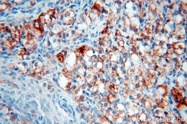 NSDHL Antibody in Immunohistochemistry (Paraffin) (IHC (P))