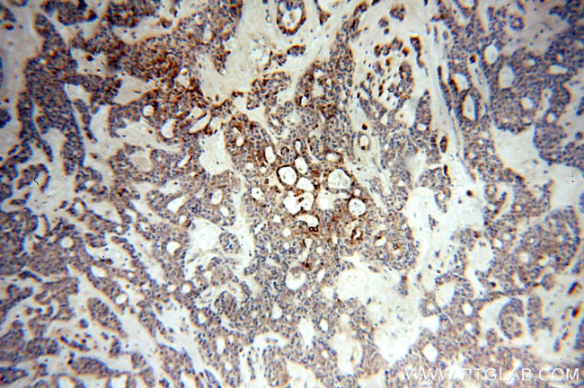 NSDHL Antibody in Immunohistochemistry (Paraffin) (IHC (P))