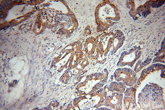 NSDHL Antibody in Immunohistochemistry (Paraffin) (IHC (P))