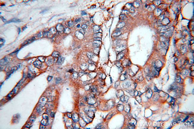 NSDHL Antibody in Immunohistochemistry (Paraffin) (IHC (P))