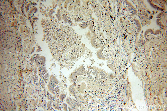 NSDHL Antibody in Immunohistochemistry (Paraffin) (IHC (P))