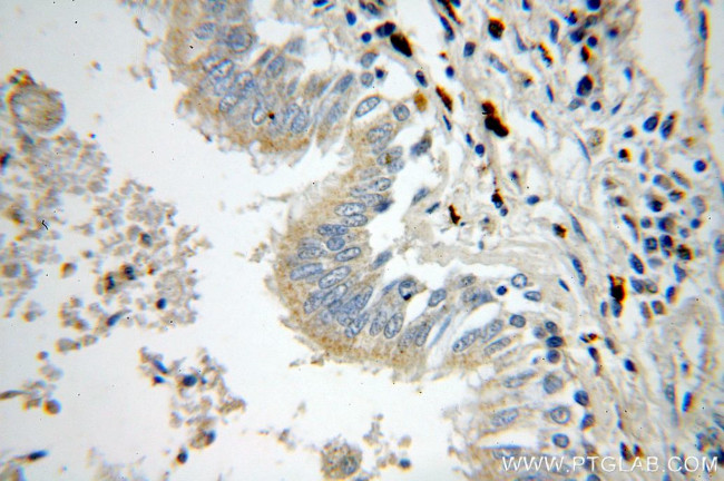 NSDHL Antibody in Immunohistochemistry (Paraffin) (IHC (P))