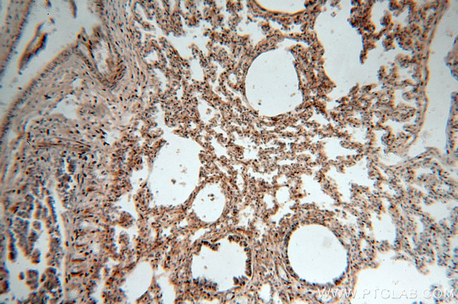 NSDHL Antibody in Immunohistochemistry (Paraffin) (IHC (P))