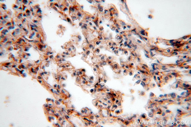 NSDHL Antibody in Immunohistochemistry (Paraffin) (IHC (P))