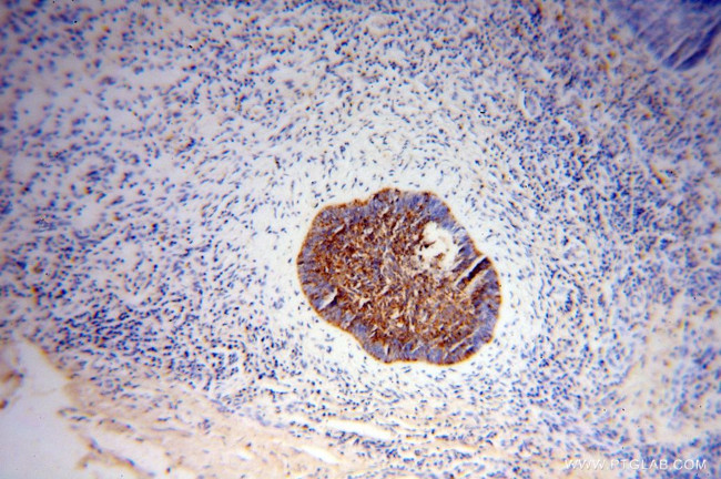 NSDHL Antibody in Immunohistochemistry (Paraffin) (IHC (P))