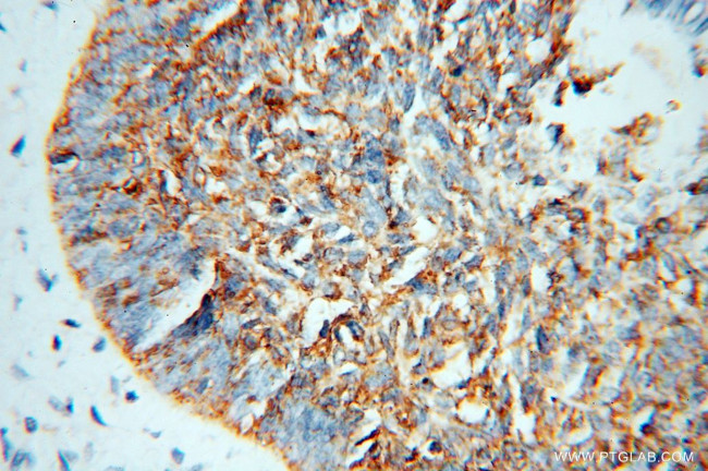 NSDHL Antibody in Immunohistochemistry (Paraffin) (IHC (P))