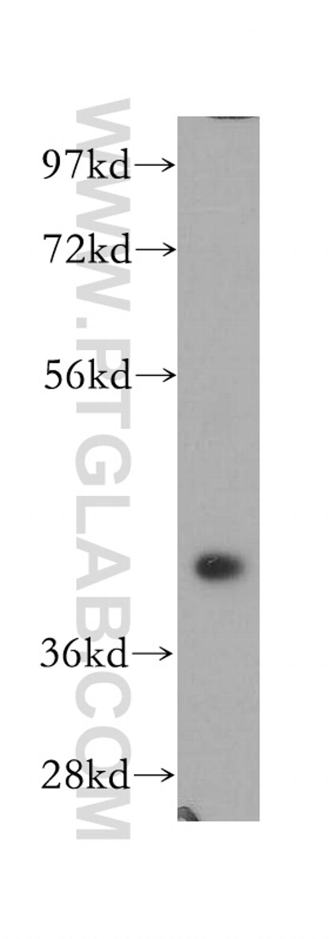 NSDHL Antibody in Western Blot (WB)