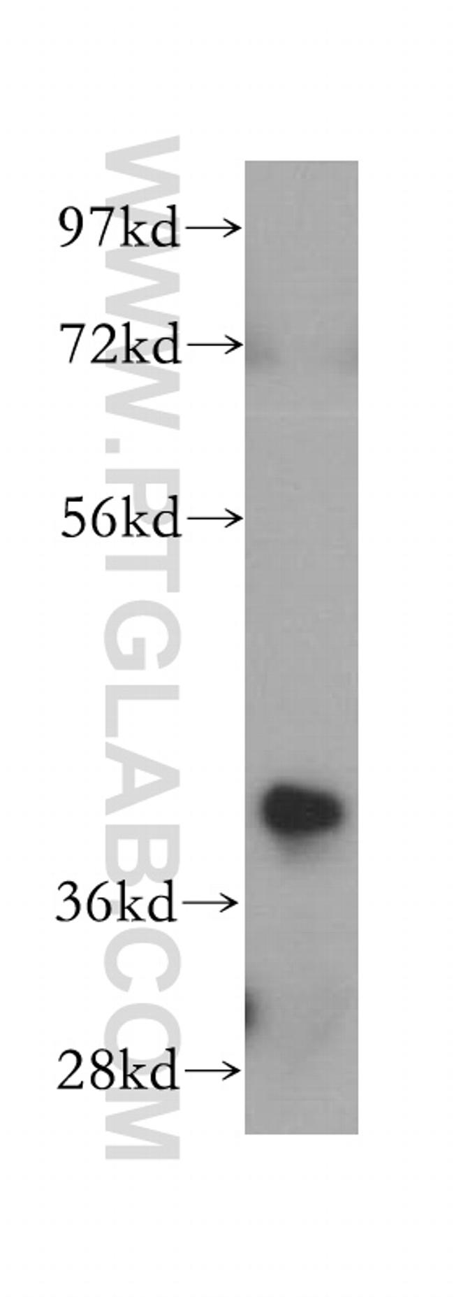 NSDHL Antibody in Western Blot (WB)