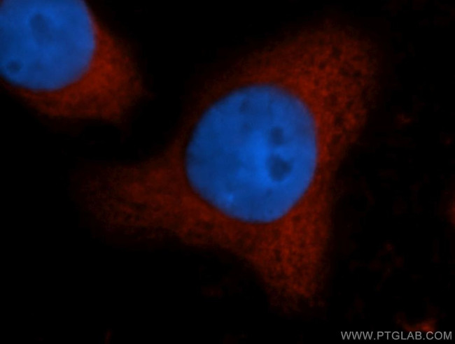 CAPRIN1 Antibody in Immunocytochemistry (ICC/IF)