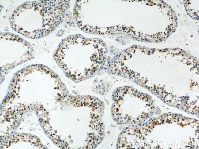 CAPRIN1 Antibody in Immunohistochemistry (Paraffin) (IHC (P))