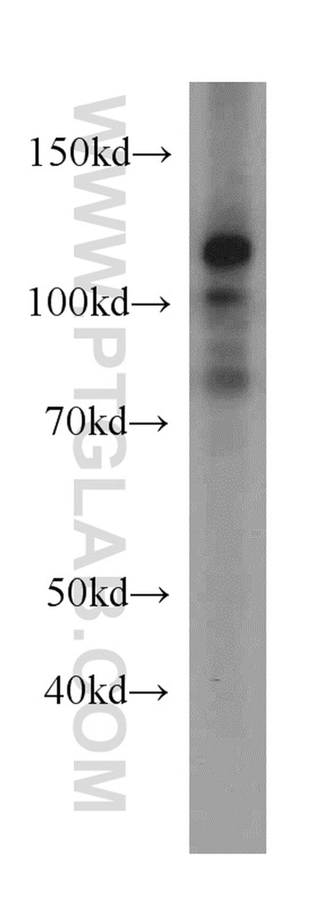 CAPRIN1 Antibody in Western Blot (WB)