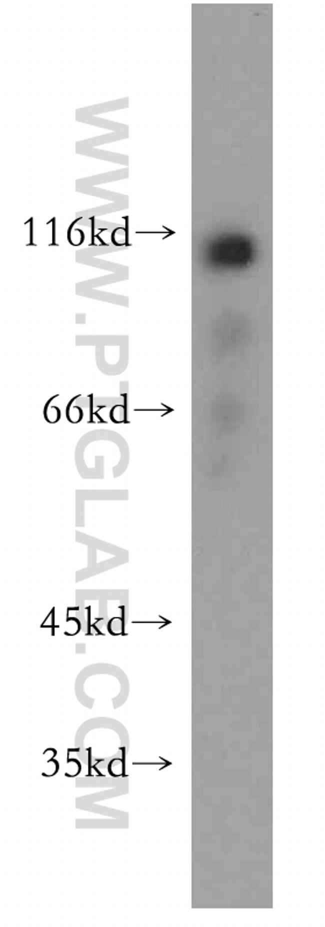 CAPRIN1 Antibody in Western Blot (WB)