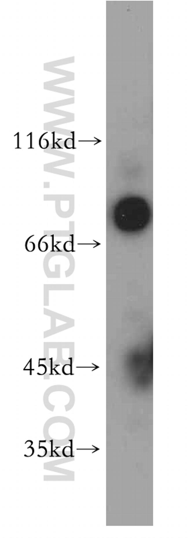 CAPRIN1 Antibody in Western Blot (WB)