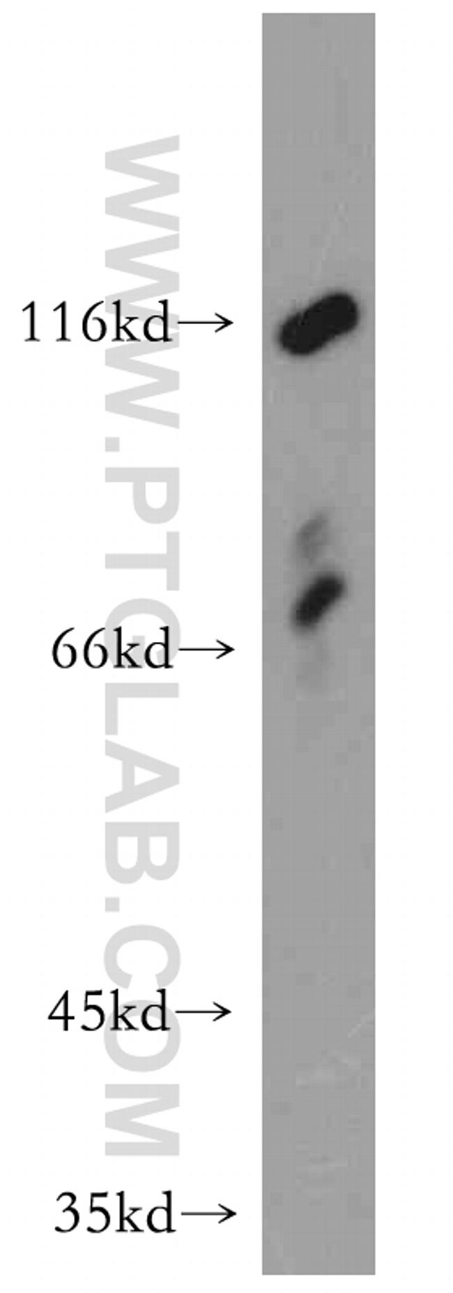 CAPRIN1 Antibody in Western Blot (WB)