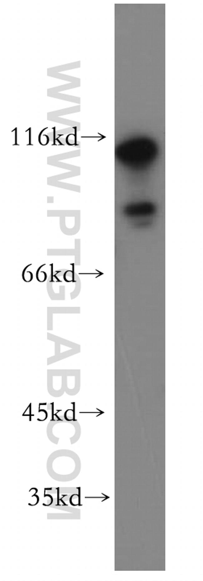 CAPRIN1 Antibody in Western Blot (WB)