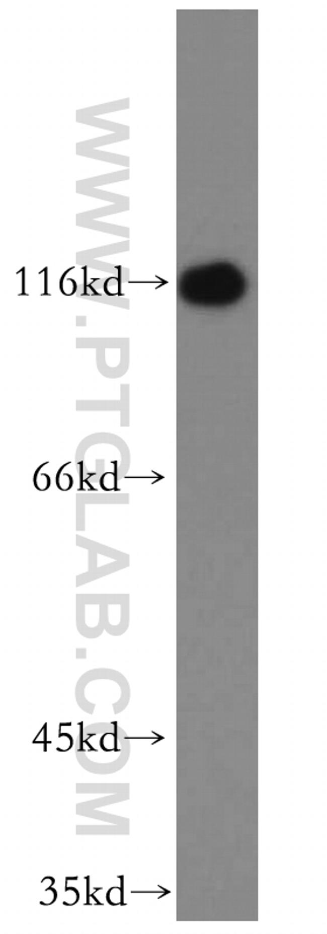 CAPRIN1 Antibody in Western Blot (WB)