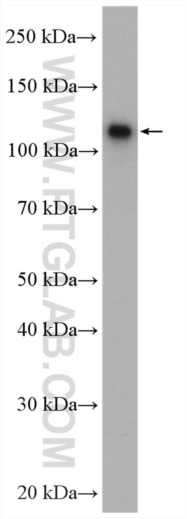 CAPRIN1 Antibody in Western Blot (WB)