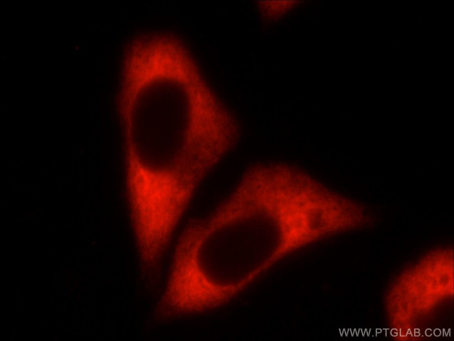 CAPRIN1 Antibody in Immunocytochemistry (ICC/IF)