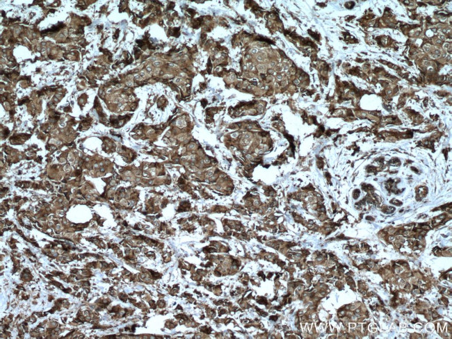 CAPRIN1 Antibody in Immunohistochemistry (Paraffin) (IHC (P))