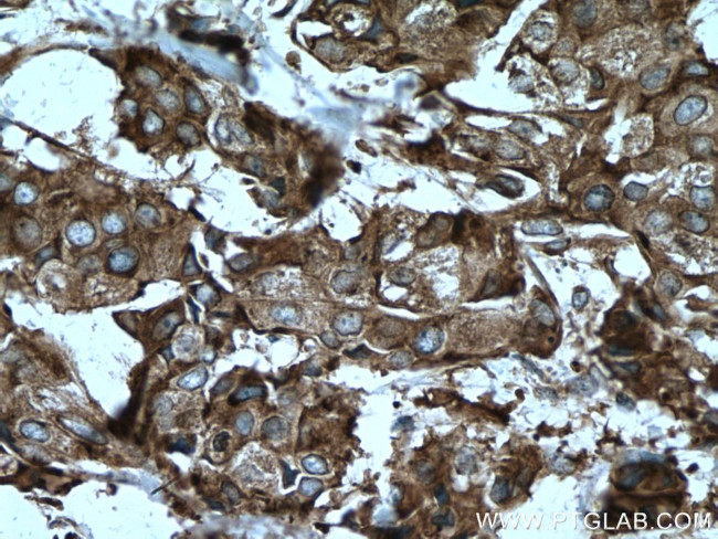 CAPRIN1 Antibody in Immunohistochemistry (Paraffin) (IHC (P))